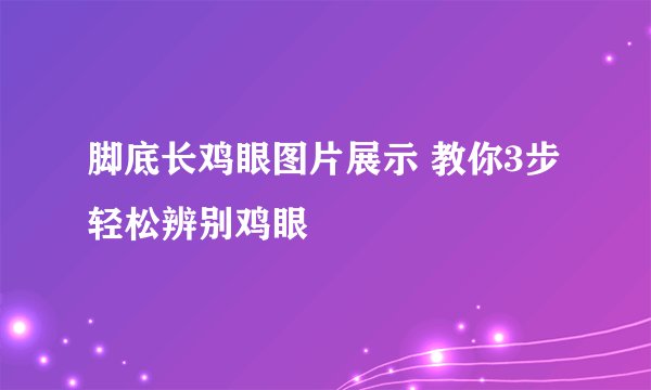 脚底长鸡眼图片展示 教你3步轻松辨别鸡眼