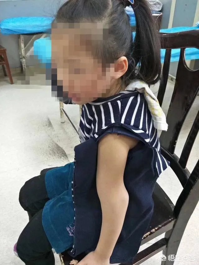 重庆一女童在幼儿园摔骨折,家长怀疑是老师报复,你怎么看?