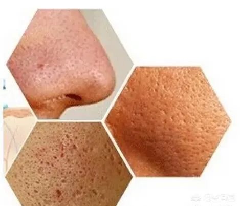 本人皮黄,混合皮肤,毛孔有点粗,很想买一种适合自己的护肤品,怎么选择?