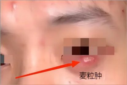 相关推荐