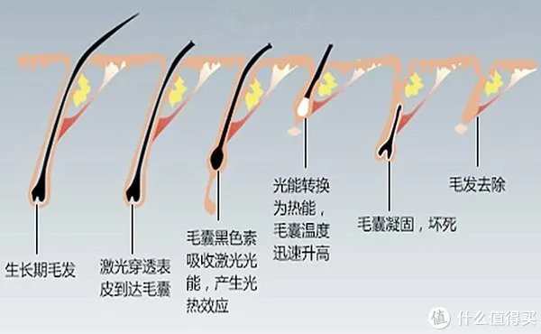 脱毛贴怎么使用