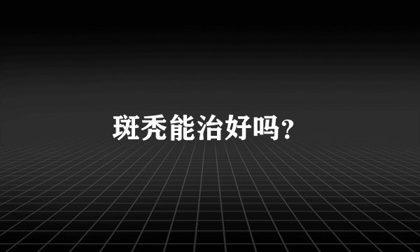 斑秃能治好吗？