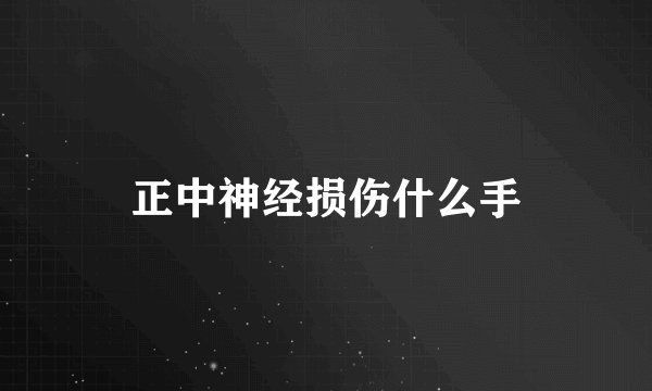 正中神经损伤什么手