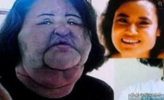 女生为了变好看变漂亮能有多拼?