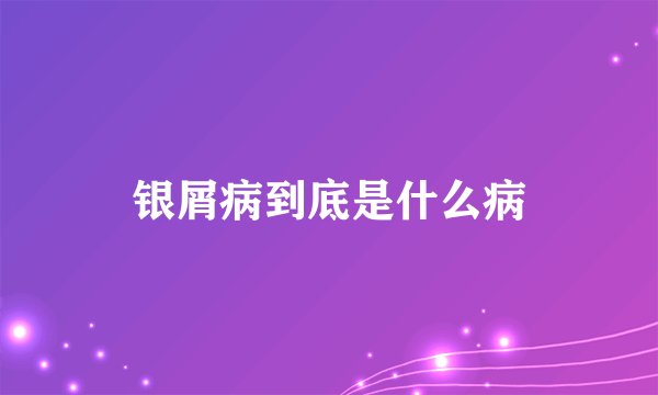 银屑病到底是什么病