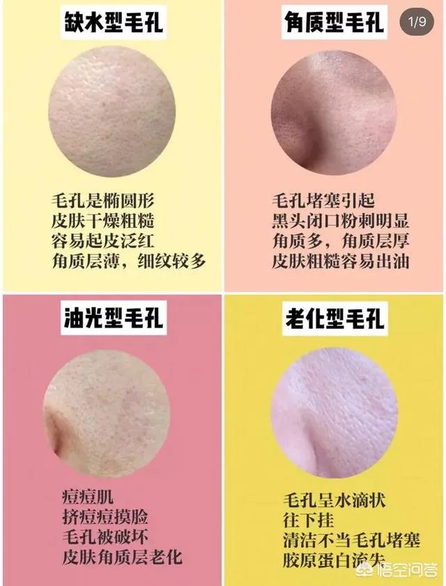 本人皮黄,混合皮肤,毛孔有点粗,很想买一种适合自己的护肤品,怎么选择?