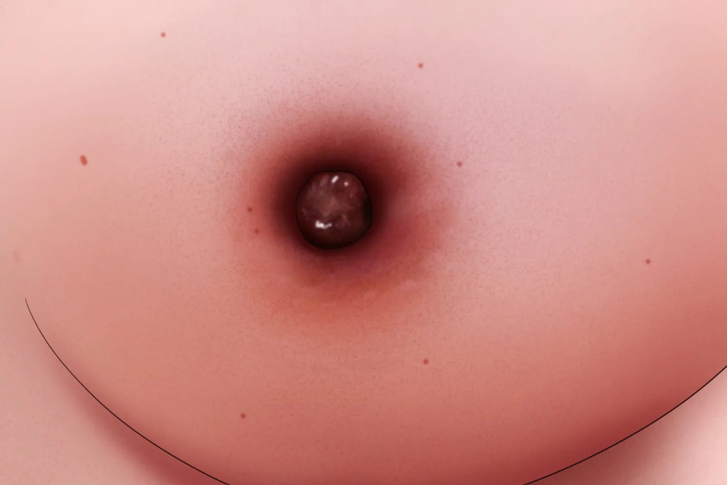乳腺恶性肿瘤图片