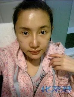 马自达唇珠是什么