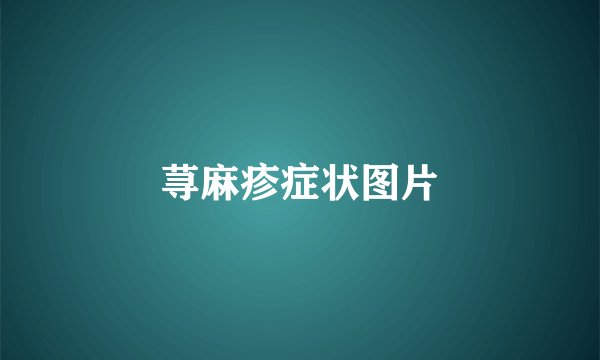 荨麻疹症状图片