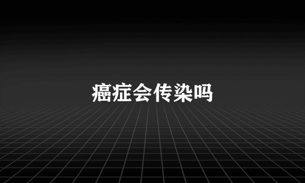 癌症会传染吗