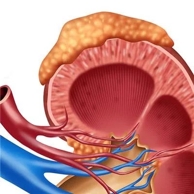肾病中医怎么治疗?