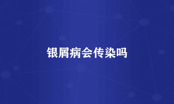 银屑病会传染吗