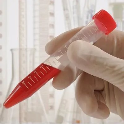 隐血3十是什么意思