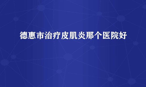 德惠市治疗皮肌炎那个医院好