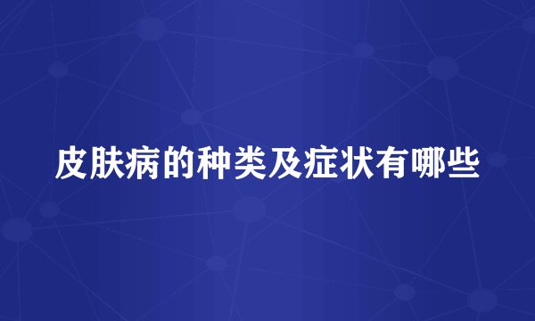 皮肤病的种类及症状有哪些