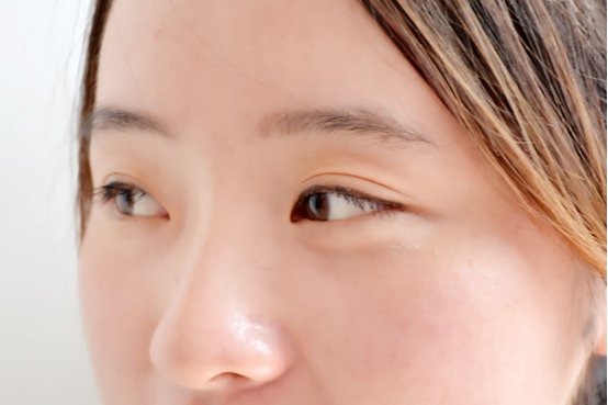 如何收缩毛孔