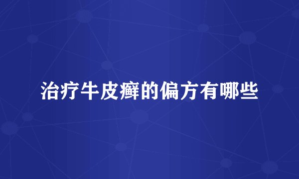治疗牛皮癣的偏方有哪些