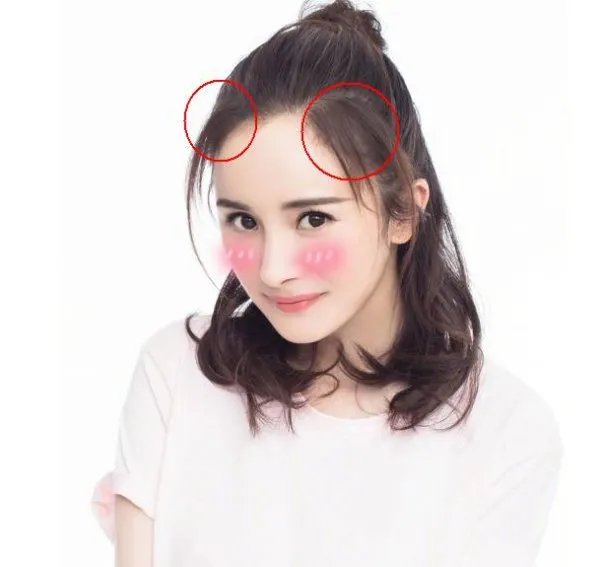 杨幂发际线回归是怎么回事?