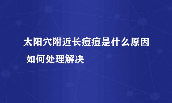 太阳穴附近长痘痘是什么原因 如何处理解决