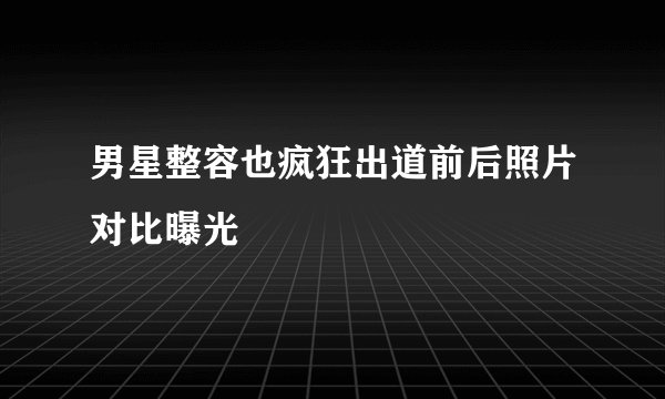 男星整容也疯狂出道前后照片对比曝光