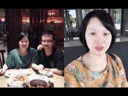 大S瘦脸前后判若两人:不手术、不打针,如何在一个月内瘦出明星V脸?