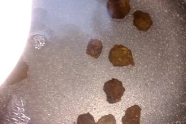 酸梅有什么功效?
