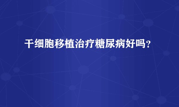 干细胞移植治疗糖尿病好吗？