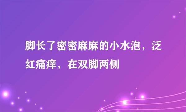 脚长了密密麻麻的小水泡，泛红痛痒，在双脚两侧