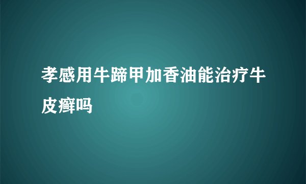 孝感用牛蹄甲加香油能治疗牛皮癣吗