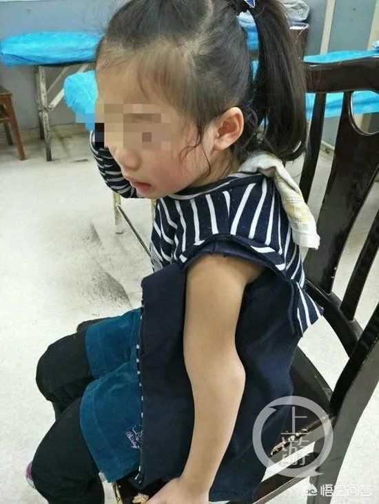 重庆一女童在幼儿园摔骨折,家长怀疑是老师报复,你怎么看?
