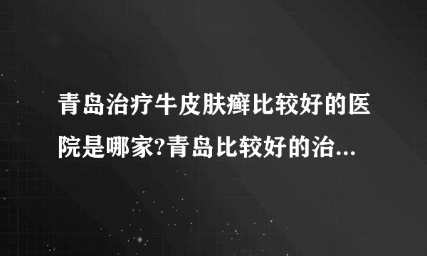 青岛治疗牛皮肤癣比较好的医院是哪家?青岛比较好的治疗银屑病医院?