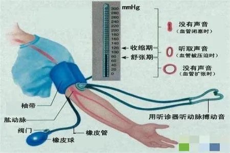 血压计的正确使用方法图片