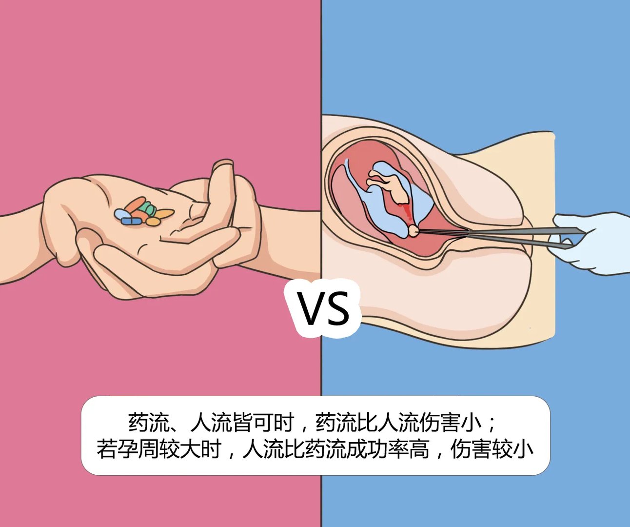 药流和人流哪个伤害小
