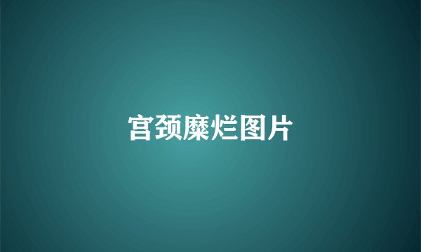 宫颈糜烂图片