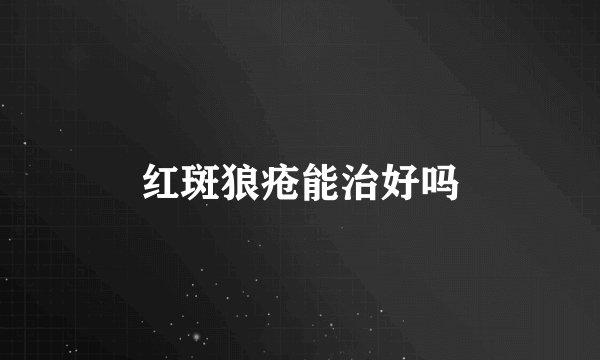 红斑狼疮能治好吗