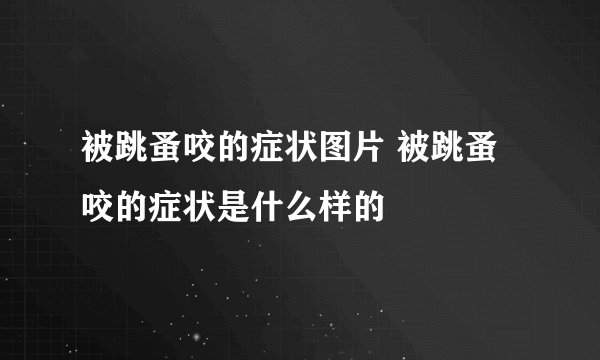 被跳蚤咬的症状图片 被跳蚤咬的症状是什么样的