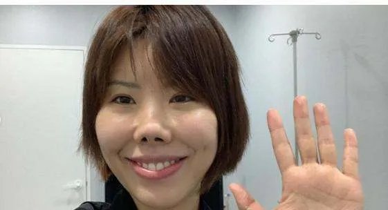 整容成猪鼻!韩国女星不小心撞断鼻子再次整容,术后仍像二师兄,你怎么看?