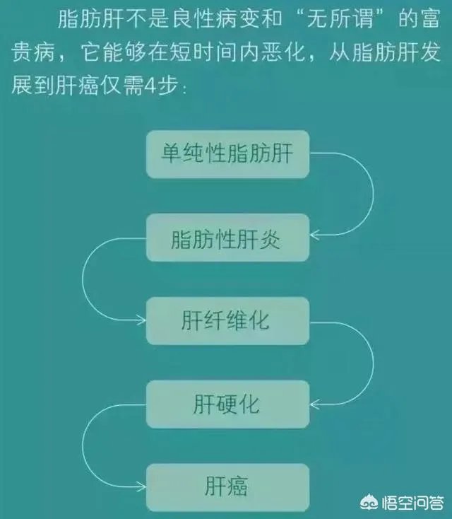 年纪轻轻中度脂肪肝,医生让减肥,你们一个月减了多少?