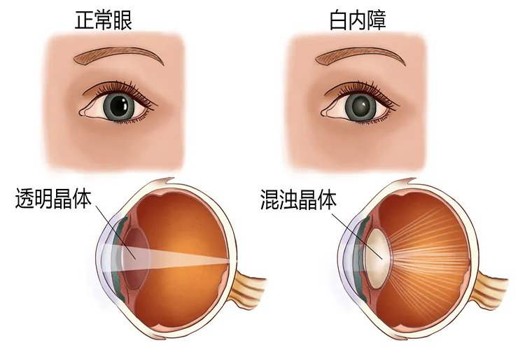 眼睛的结构图
