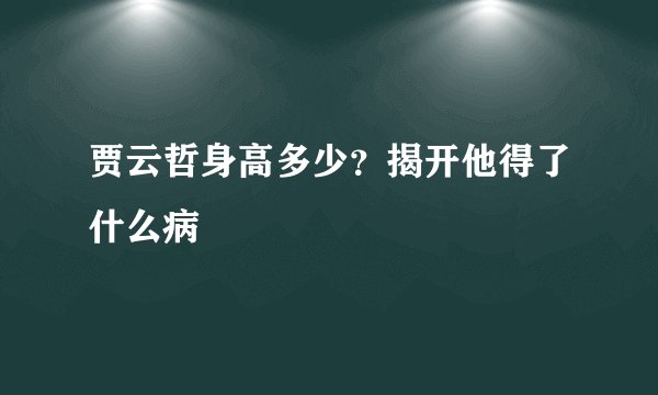 贾云哲身高多少？揭开他得了什么病