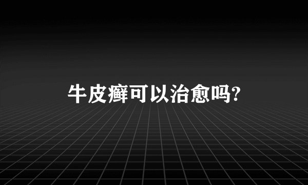 牛皮癣可以治愈吗?