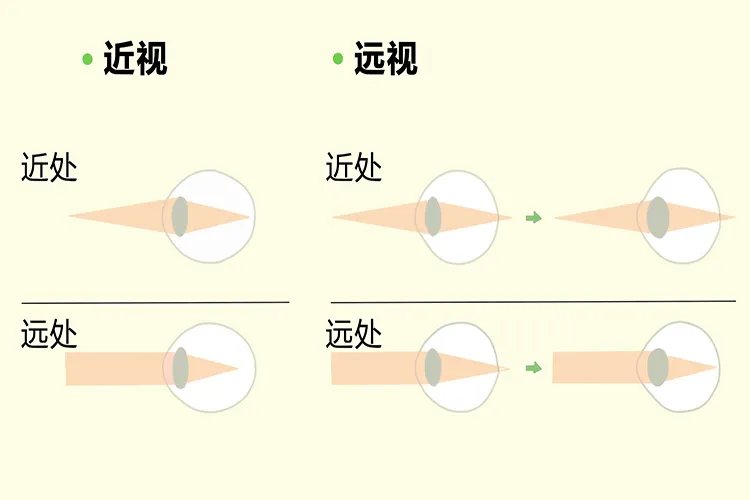 眼睛的结构图