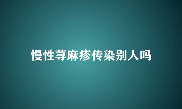 慢性荨麻疹传染别人吗