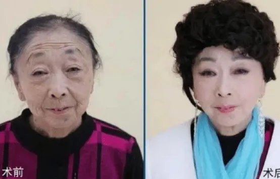 当年声称自己不后悔,娶了60岁整容老太的25岁小伙子,现在怎样了?